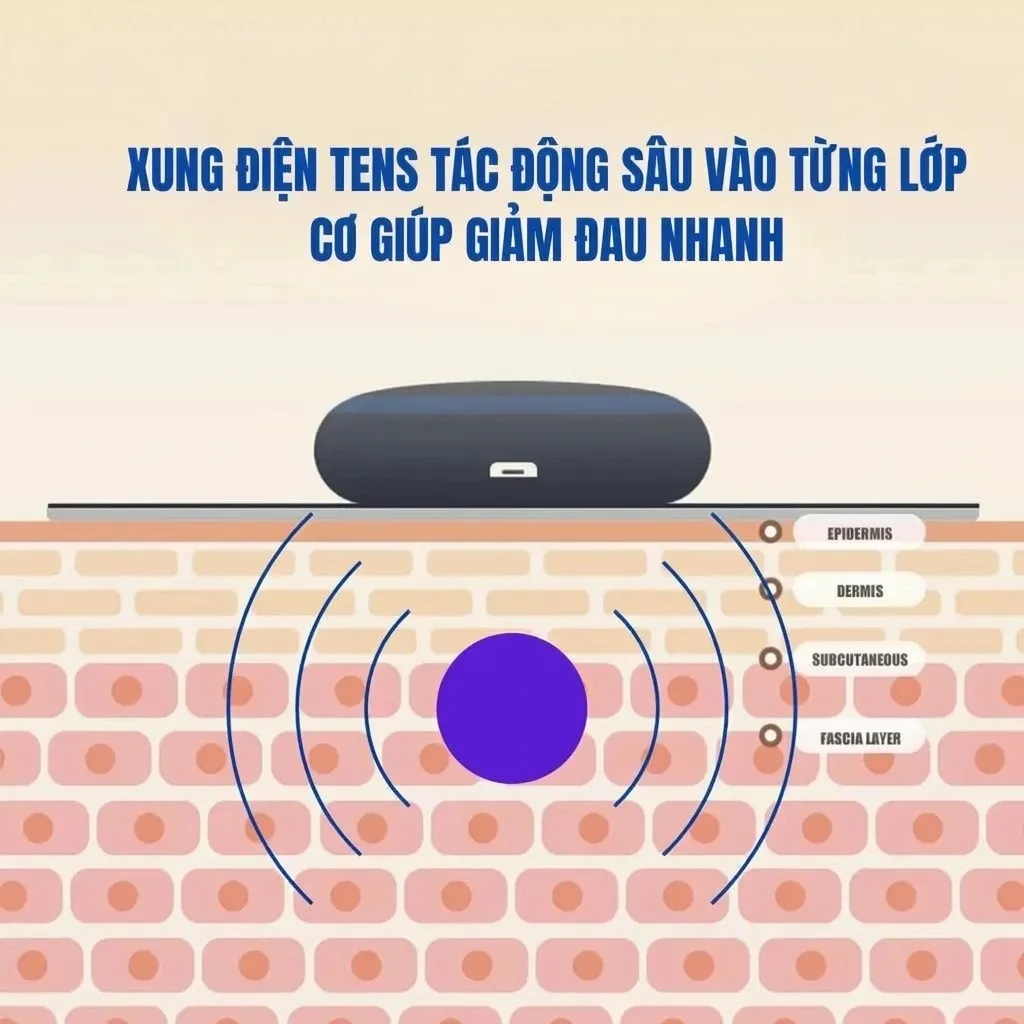 Công nghệ EMS